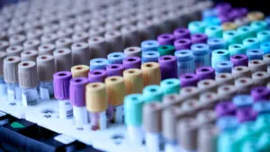 Plusieurs tubes de prélèvement sanguin prêts pour une analyse médicale en laboratoire.
