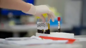 Gant médical manipulant des tubes de prélèvement sanguin en laboratoire d'analyse médicale.